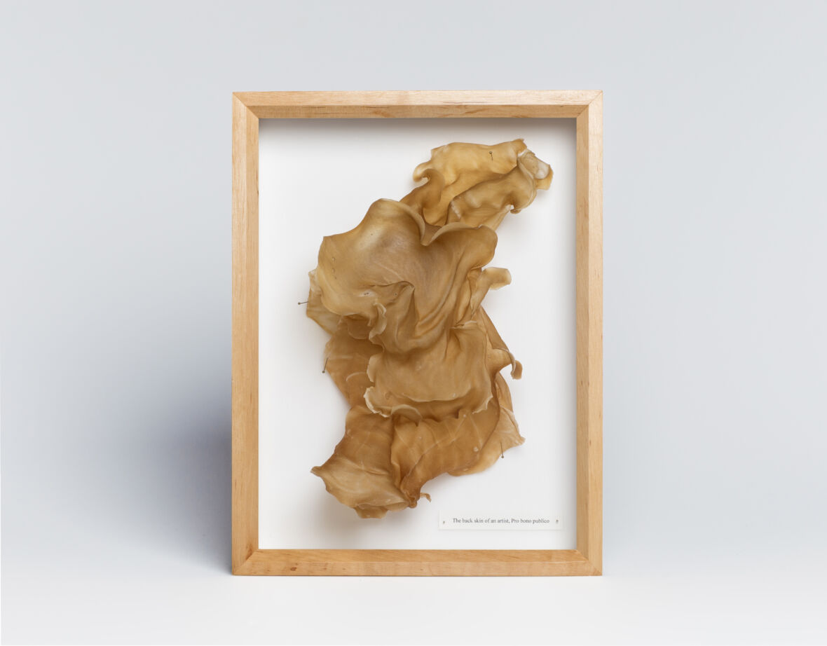 The back skin of an artist, Pro bono publico