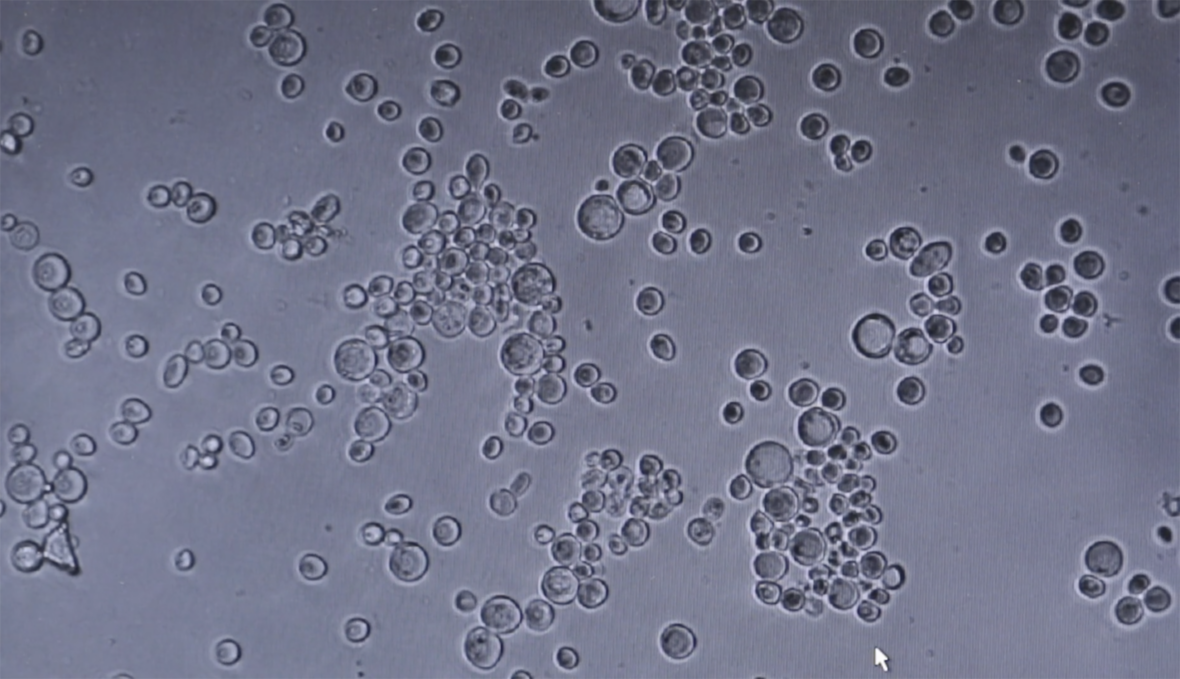 Hiivasolut / Yeast Cells -video